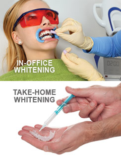 Teeth Whitening Options PIscataway, NJ
